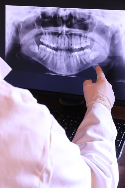 Best Emergency Wisdom Teeth Removal in High Point, FL